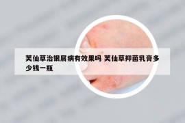 芙仙草治銀屑病有效果嗎 芙仙草抑菌乳膏多少錢一瓶