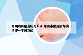 鄭州銀屑病當(dāng)聽(tīng)劉長(zhǎng)江 鄭州市銀屑病專(zhuān)病門(mén)診哪一年成立的