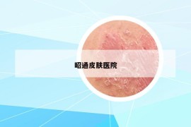 昭通皮膚醫(yī)院