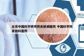 北京中國科學研究院皮膚病醫(yī)院 中國科學院皮膚科醫(yī)院