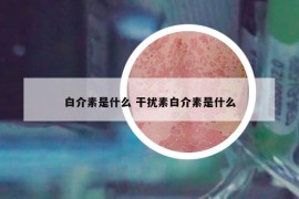 白介素是什么 干擾素白介素是什么