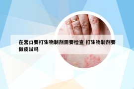 在營(yíng)口要打生物制劑需要檢查 打生物制劑要做皮試嗎