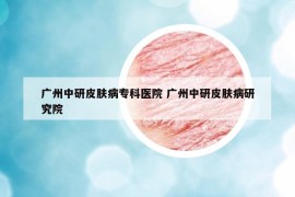 廣州中研皮膚病?？漆t(yī)院 廣州中研皮膚病研究院