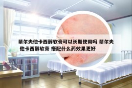 萌爾夫他卡西醇軟膏可以長期使用嗎 萌爾夫 他卡西醇軟膏 搭配什么藥效果更好