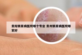 貴陽銀屑病醫(yī)院哪個專業(yè) 貴州銀屑病醫(yī)院哪家好