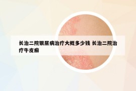 長(zhǎng)治二院銀屑病治療大概多少錢 長(zhǎng)治二院治療牛皮癬