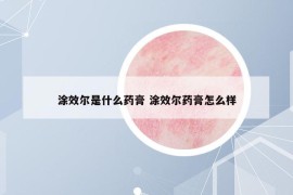 涂效爾是什么藥膏 涂效爾藥膏怎么樣