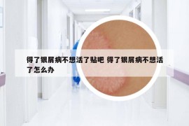 得了銀屑病不想活了貼吧 得了銀屑病不想活了怎么辦