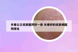 長(zhǎng)春公立皮膚醫(yī)院好一些 長(zhǎng)春好的皮膚病醫(yī)院排名
