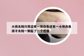 小孩太陽(yáng)穴旁邊有一塊白色還有一小塊白色 孩子太陽(yáng)一側(cè)起了一個(gè)疙瘩