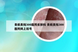貴航貴陽300醫(yī)院皮膚科 貴航貴陽300醫(yī)院網(wǎng)上掛號(hào)