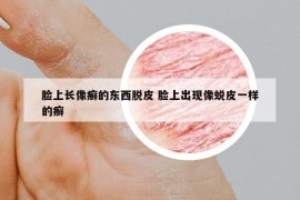 臉上長(zhǎng)像癬的東西脫皮 臉上出現(xiàn)像蛻皮一樣的癬