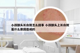 小孩額頭長(zhǎng)白斑怎么回事 小孩額頭上長(zhǎng)白斑是什么原因造成的