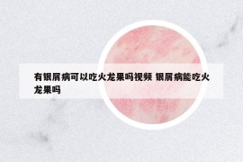 有銀屑病可以吃火龍果嗎視頻 銀屑病能吃火龍果嗎