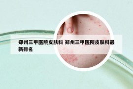 鄭州三甲醫(yī)院皮膚科 鄭州三甲醫(yī)院皮膚科最新排名