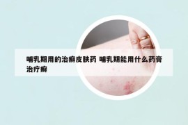 哺乳期用的治癬皮膚藥 哺乳期能用什么藥膏治療癬
