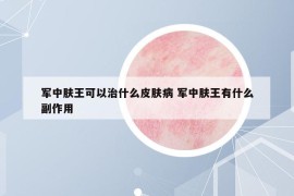 軍中膚王可以治什么皮膚病 軍中膚王有什么副作用