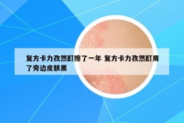 復(fù)方卡力孜然酊擦了一年 復(fù)方卡力孜然酊用了旁邊皮膚黑