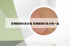 生物制劑針多少錢 生物制劑針多少錢一盒