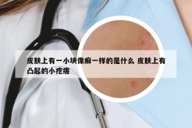 皮膚上有一小塊像癬一樣的是什么 皮膚上有凸起的小疙瘩