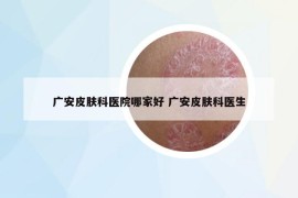 廣安皮膚科醫(yī)院哪家好 廣安皮膚科醫(yī)生