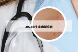 2023年牛皮癬新突破