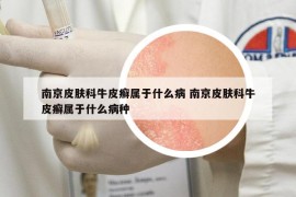 南京皮膚科牛皮癬屬于什么病 南京皮膚科牛皮癬屬于什么病種