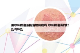 用珍珠粉泡浴能治銀屑病嗎 珍珠粉泡澡的好處與壞處