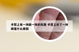 手臂上有一塊蘚一樣的東西 手臂上長(zhǎng)了一塊癬是什么原因