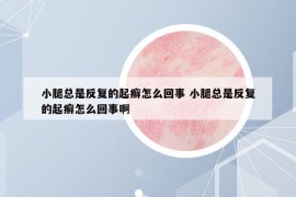 小腿總是反復(fù)的起癬怎么回事 小腿總是反復(fù)的起癬怎么回事啊