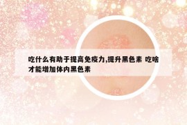 吃什么有助于提高免疫力,提升黑色素 吃啥才能增加體內(nèi)黑色素