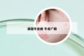 商路牛皮癬 牛皮廣癬