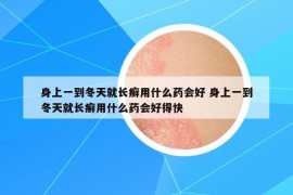 身上一到冬天就長癬用什么藥會好 身上一到冬天就長癬用什么藥會好得快