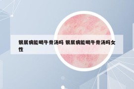 銀屑病能喝牛骨湯嗎 銀屑病能喝牛骨湯嗎女性