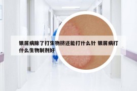 銀屑病除了打生物擠還能打什么針 銀屑病打什么生物制劑好