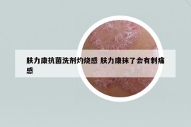 膚力康抗菌洗劑灼燒感 膚力康抹了會(huì)有刺痛感