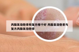 丙酸氯倍他索和復(fù)方哪個好 丙酸氯倍他索與復(fù)方丙酸氯倍他索