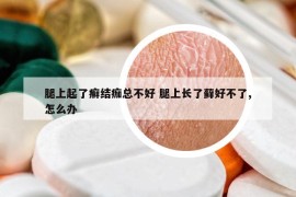 腿上起了癬結(jié)痂總不好 腿上長(zhǎng)了蘚好不了,怎么辦
