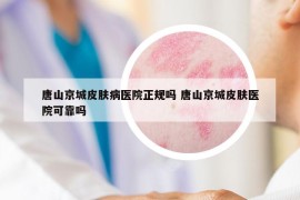唐山京城皮膚病醫(yī)院正規(guī)嗎 唐山京城皮膚醫(yī)院可靠嗎