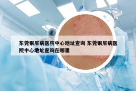 東莞銀屑病醫(yī)院中心地址查詢 東莞銀屑病醫(yī)院中心地址查詢在哪里