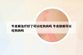 牛皮癬治療好了可以吃狗肉嗎 牛皮膚癬可以吃狗肉嗎