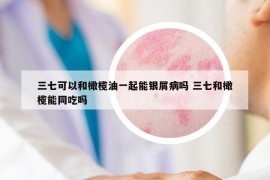 三七可以和橄欖油一起能銀屑病嗎 三七和橄欖能同吃嗎