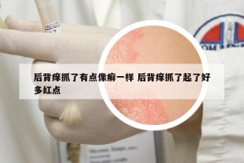 后背癢抓了有點(diǎn)像癬一樣 后背癢抓了起了好多紅點(diǎn)