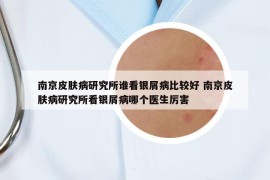 南京皮膚病研究所誰(shuí)看銀屑病比較好 南京皮膚病研究所看銀屑病哪個(gè)醫(yī)生厲害
