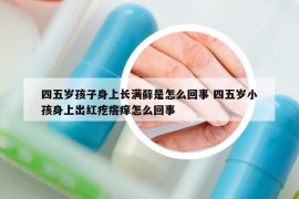 四五歲孩子身上長(zhǎng)滿蘚是怎么回事 四五歲小孩身上出紅疙瘩癢怎么回事