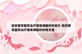 南京那家醫(yī)院治療銀屑病最好的地方 南京那家醫(yī)院治療銀屑病最好的地方是