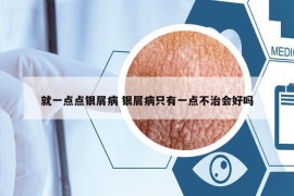 就一點點銀屑病 銀屑病只有一點不治會好嗎