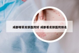 成都哪家皮膚醫(yī)院好 成都看皮膚醫(yī)院排名