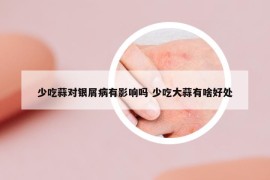 少吃蒜對(duì)銀屑病有影響嗎 少吃大蒜有啥好處