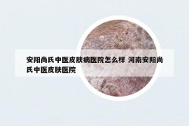 安陽尚氏中醫(yī)皮膚病醫(yī)院怎么樣 河南安陽尚氏中醫(yī)皮膚醫(yī)院